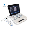  K-H101S Laptop Ultrasound Machine