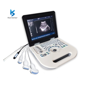  K-H101S Laptop Ultrasound Machine