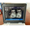 K-H101S ultrasound machine black and white ultrasound scan Veterinary portable ultrasound price