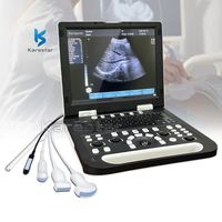 K-H300 Full Digital Portable B/W ecografo Machine Portable Color Ultrasound Scanner