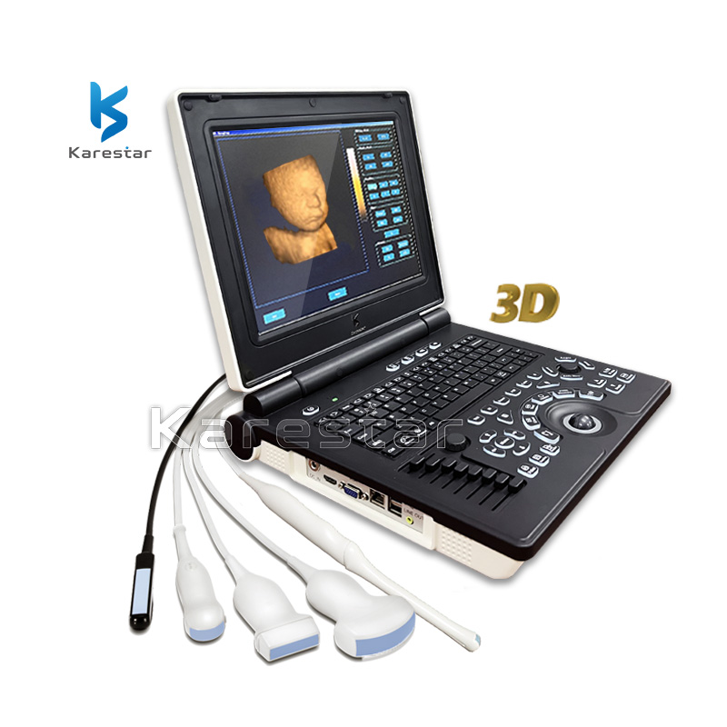 K-C100 Full-digital PW Laptop Ultrasound Scanner