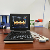 K-C100 Full-digital PW Laptop Ultrasound Scanner