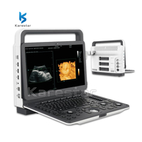 K-C600 Portable 3D/4D Color Doppler Ultrasound