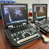 K-H300 Laptop Ultrasound Machine