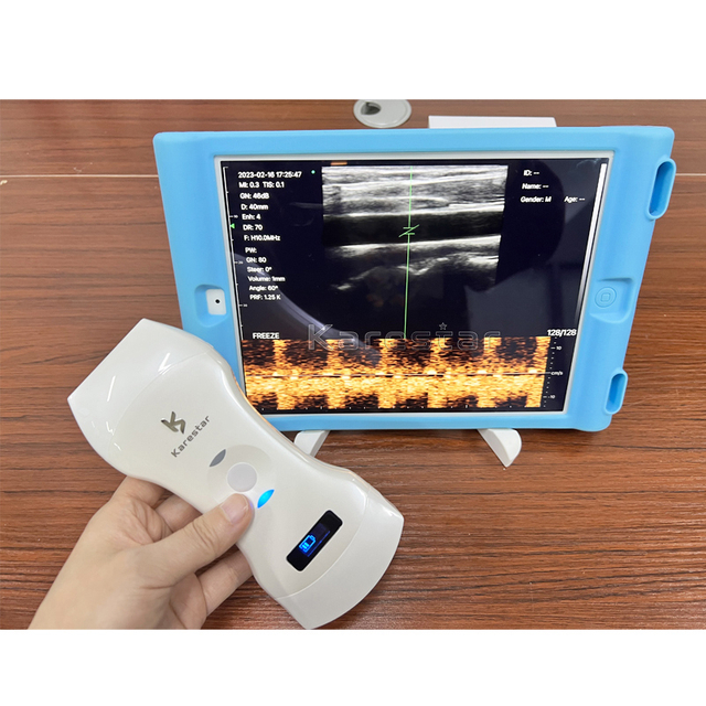 K-TC101 3 in 1 Wireless Probe Ultrasound Machine