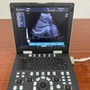 K-H300 Laptop Ultrasound Machine