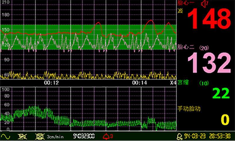 K-FM50 (11)