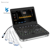 Karestar 15.6 Inches LCD Screen Gynecology Portable 3D Color Doppler Ultrasound Machine